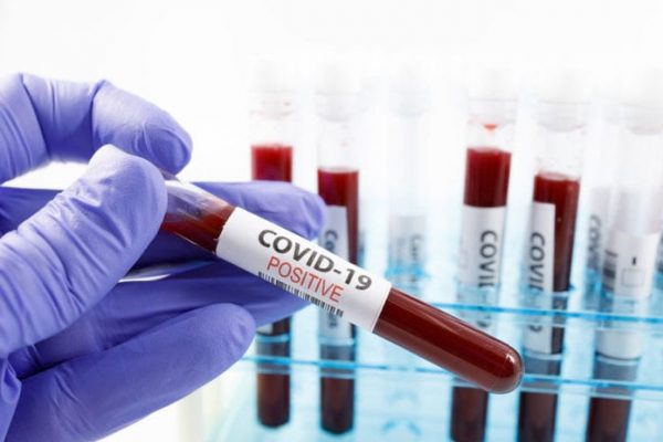 koronavirüs (covid-19) kan pıhtılaşmasına neden oluyor